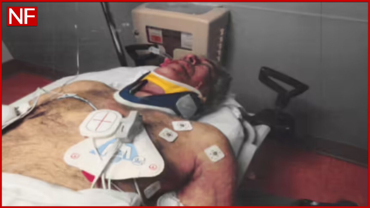 Image shows medical monitoring equipment attached to Epstein